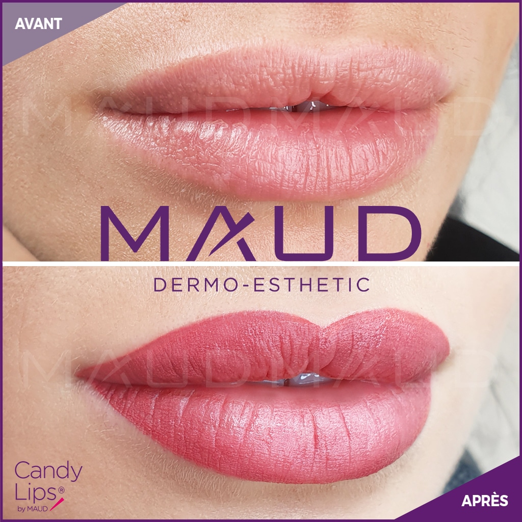 Candy-Lips-Site-web-1 (1)