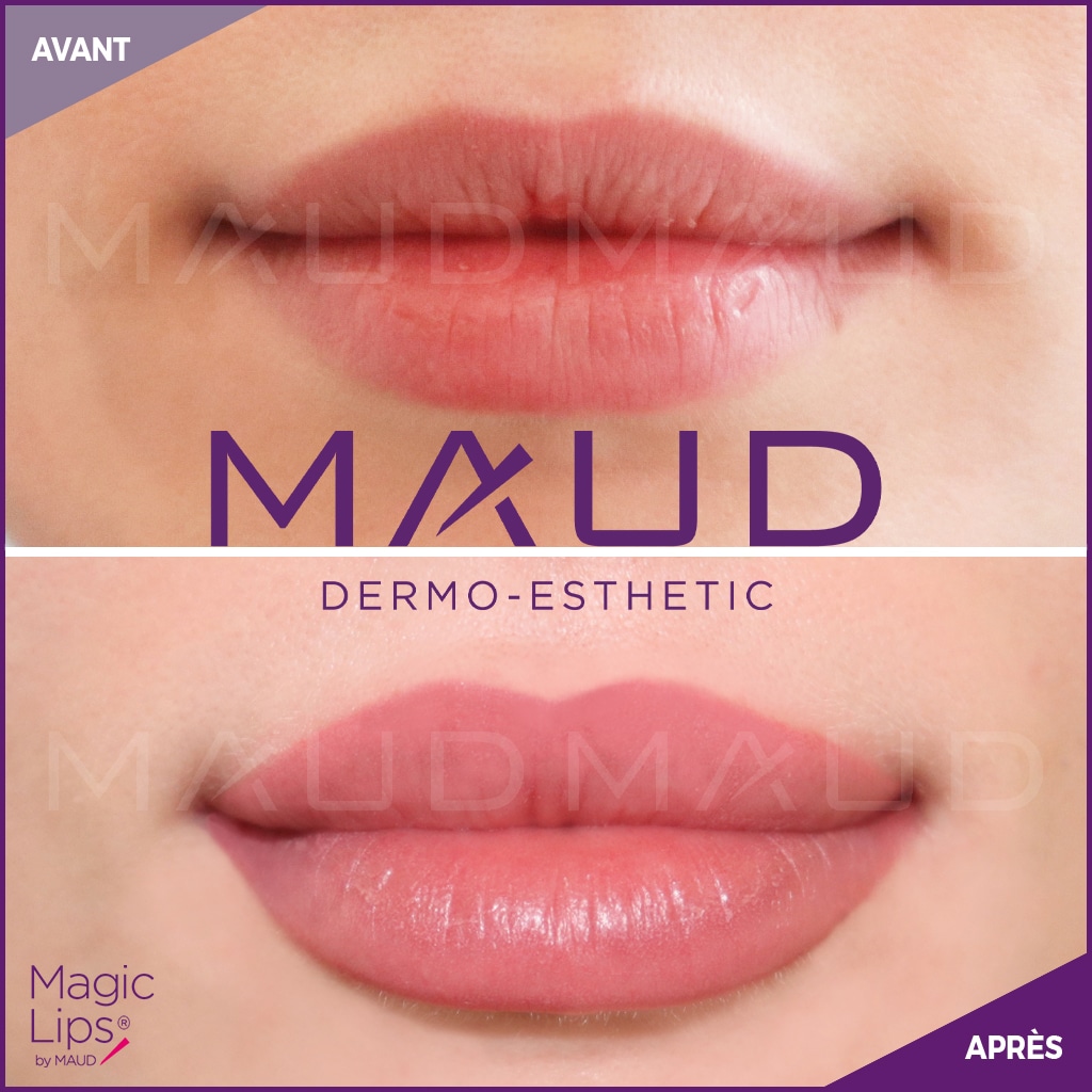 Magic-Lips-Website_